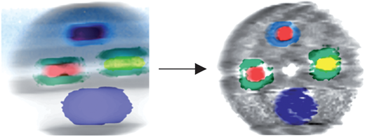 Test Object Definition Reconstructive colour X-ray diffraction imaging – a novel TEDDI imaging ...