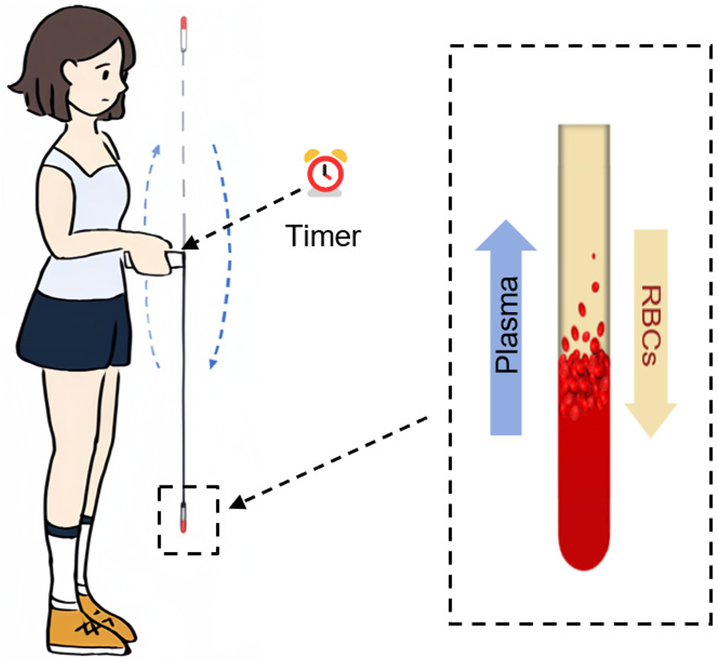 Simple Sample Point Rope-skipping for blood plasma separation in point-of-care testing ...