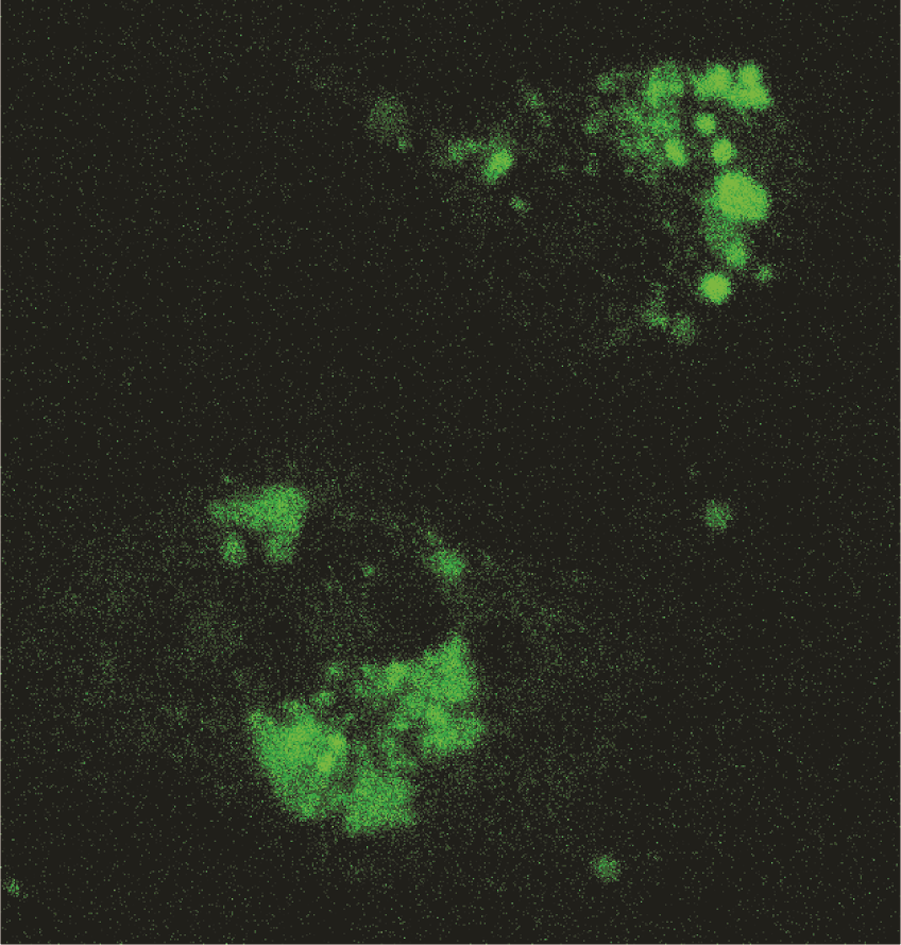 Lanthanide-doped calcium phosphate nanoparticles with high internal ...