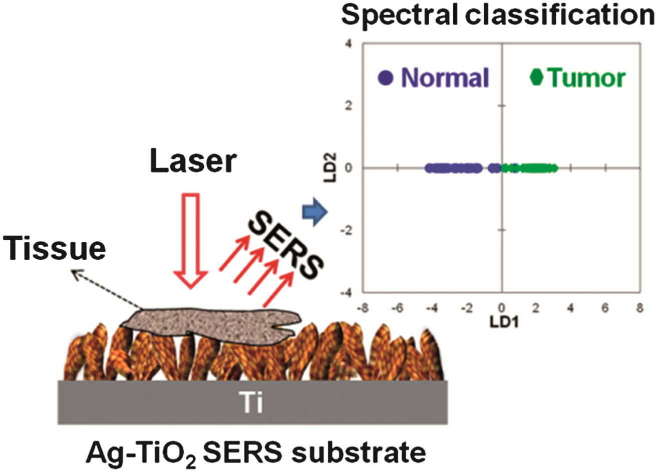 Rapid detection of oral cancer using Ag–TiO2 nanostructured surface ...